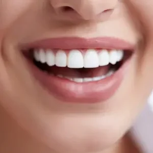 Cómo lograr una sonrisa alineada