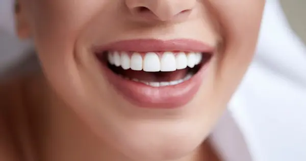Cómo lograr una sonrisa alineada